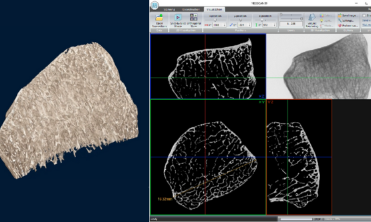 显微CT：解密骨骼微结构的科学利器